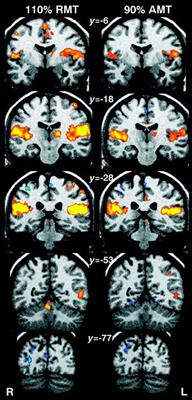 Combined rTMS/fMRI Studies: An Overlooked Resource in Animal Models